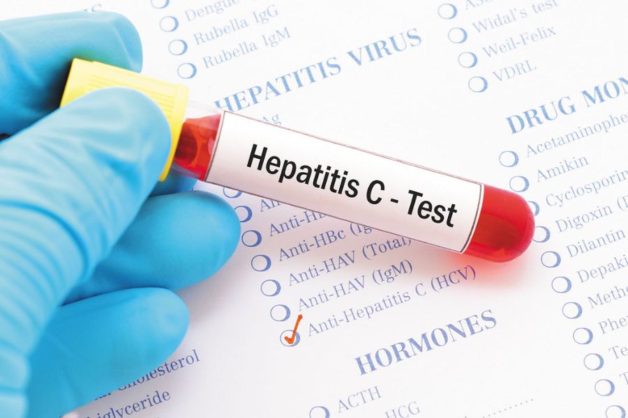 ویروس هپاتیت C چگونه تشخیص داده می‌شود؟